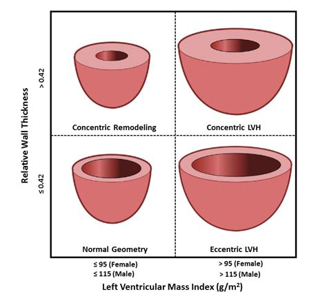 lv wall thickness measurement|left ventricle increased wall thickness.